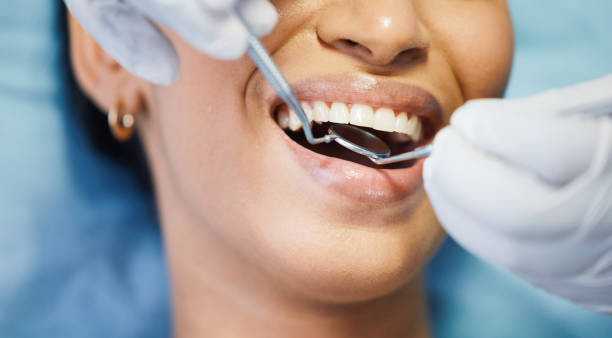 Best Same-Day Emergency Dentist in Aragon, GA